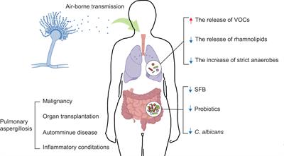 Lung and gut microbiomes in pulmonary aspergillosis: Exploring adjunctive therapies to combat the disease